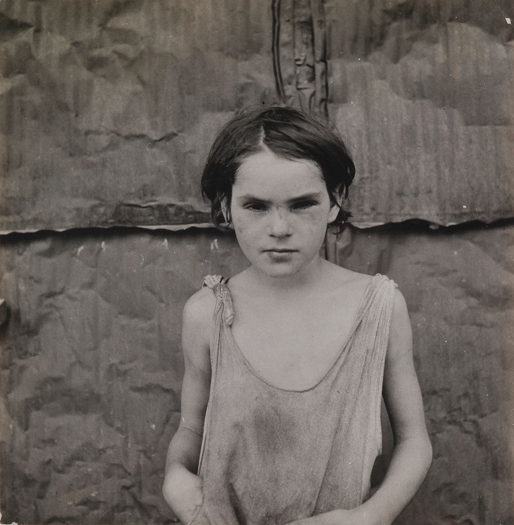 Dorothea Lange Art Print - Damaged Child